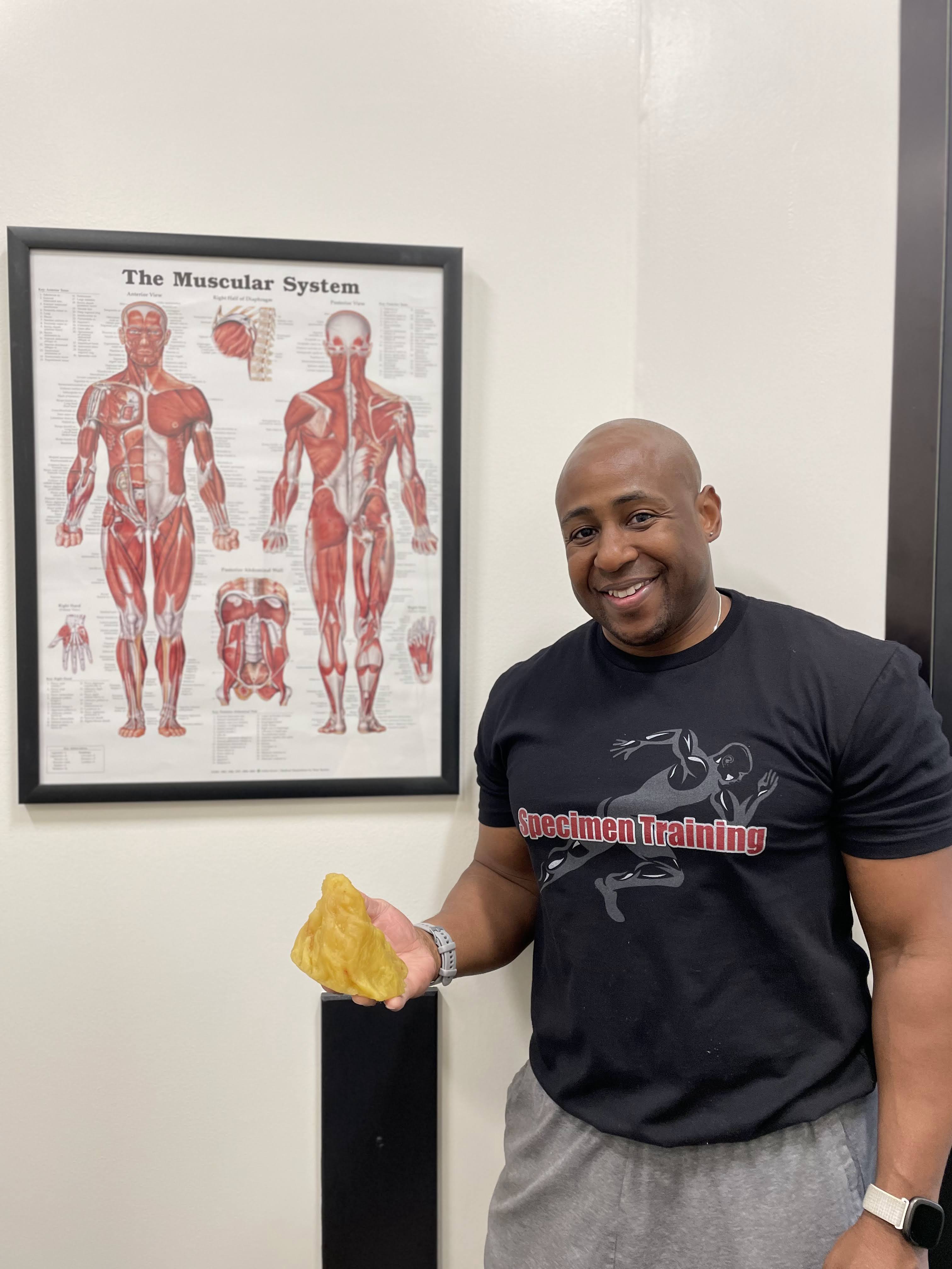 Exercise and Fat Metabolism